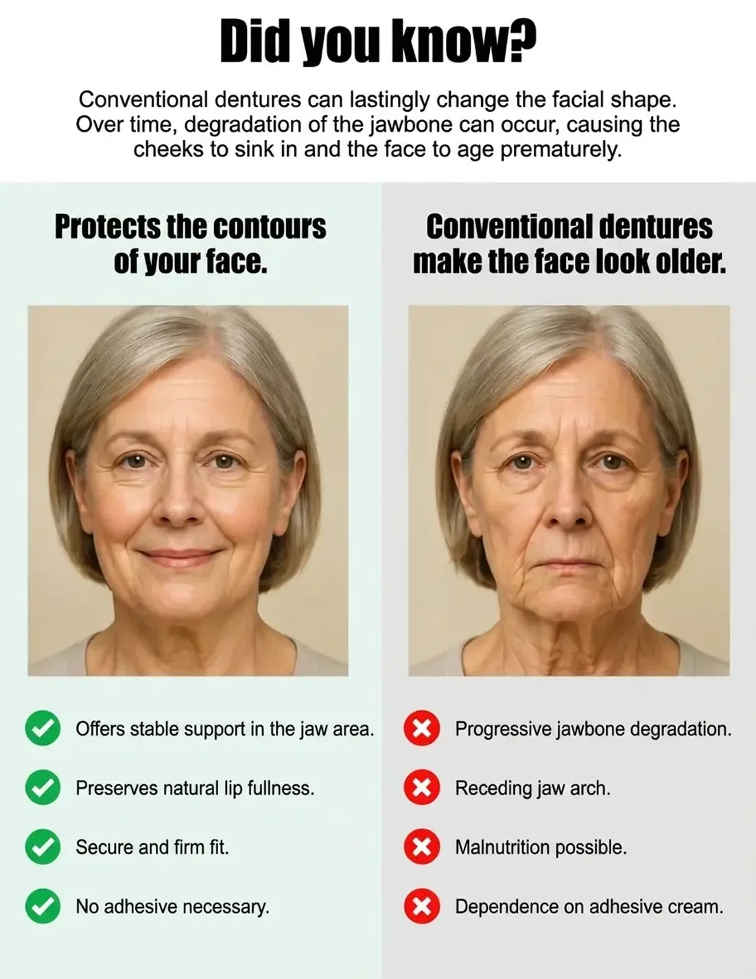 German Medical-Grade Snap-In Full Dentures