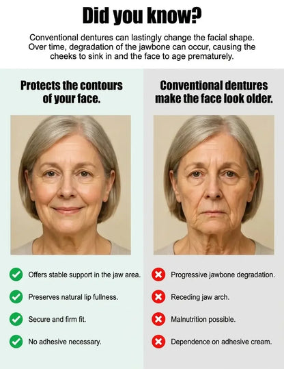 German Medical-Grade Snap-In Full Dentures