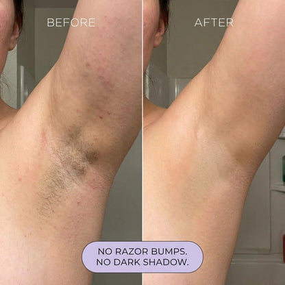 🔥Last Day 49% OFF -  Koas Hair Removal Mousse Hypoallergenic formula 🌿💧