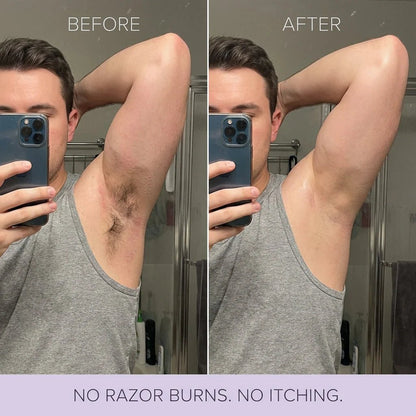 🔥Last Day 49% OFF -  Koas Hair Removal Mousse Hypoallergenic formula 🌿💧