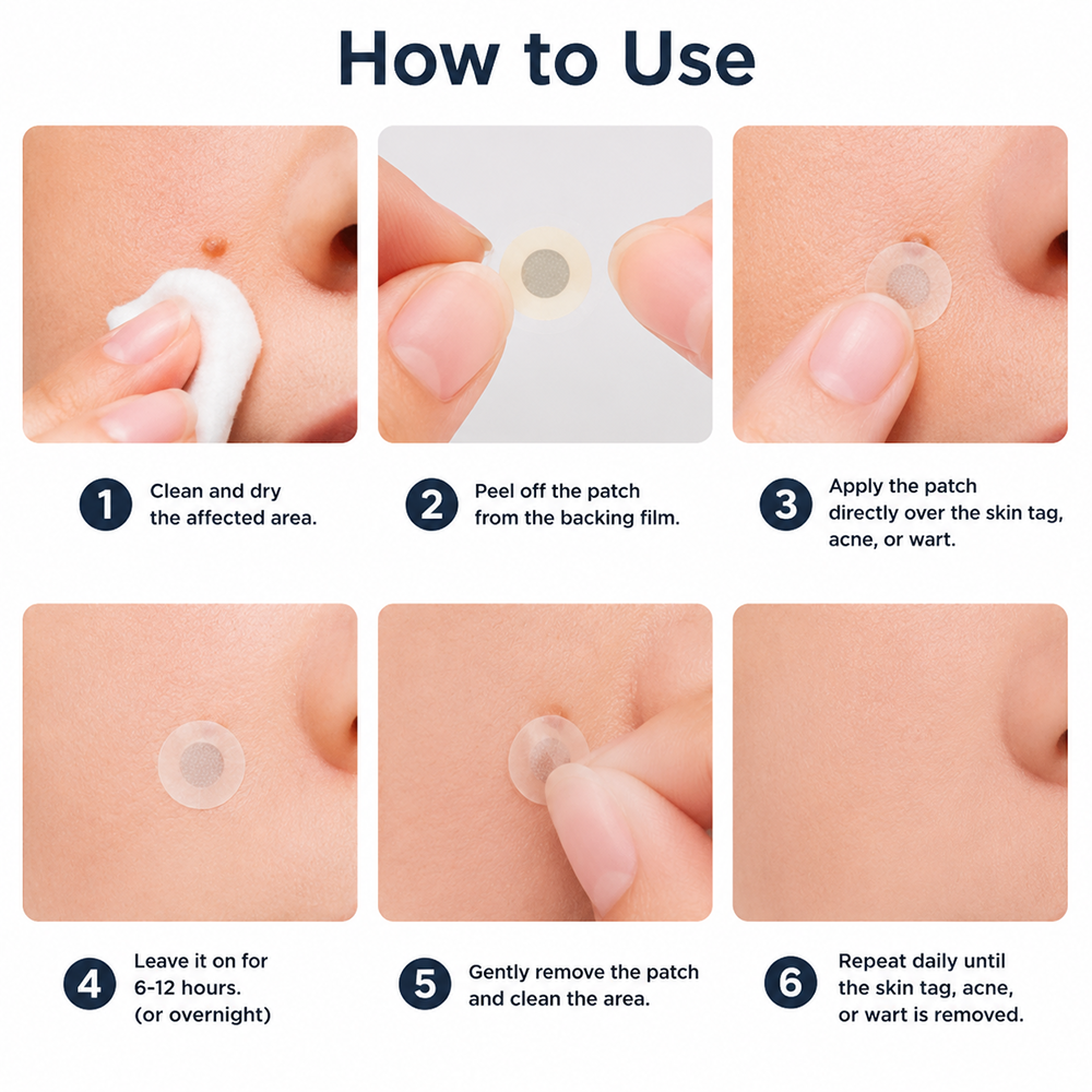 🎉🎉𝐇𝐢𝐬𝐤𝐢𝐧® 2-in-1 Microneedle & Hydrocolloid Patch | Removes raised moles, acne, flat warts, and skin tags | Helps improve wrinkles, scars, and blemishes | Invisible patches for face and body