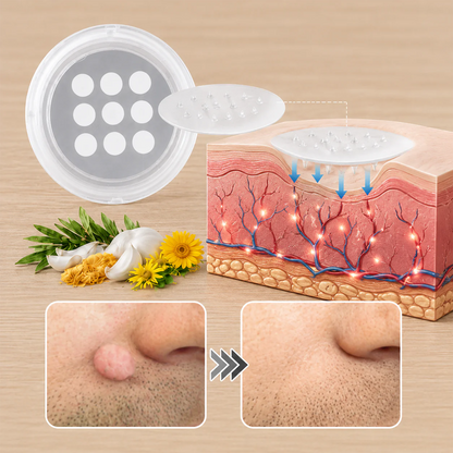 🎉🎉𝐇𝐢𝐬𝐤𝐢𝐧® 2-in-1 Microneedle & Hydrocolloid Patch | Removes raised moles, acne, flat warts, and skin tags | Helps improve wrinkles, scars, and blemishes | Invisible patches for face and body
