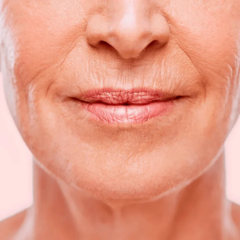 Fine Lines & wrinkles