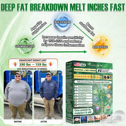 𝐎𝐟𝐟𝐢𝐜𝐢𝐚𝐥 𝐔𝐒 𝐒𝐭𝐨𝐫𝐞 🇺🇸 | ✅𝐆𝐞𝐞𝐋𝐞𝐦𝐨𝐧® Moringa · Berberine × NAD+ 𝟏𝟎-𝐢𝐧-𝟏 𝐀𝐝𝐯𝐚𝐧𝐜𝐞𝐝 𝐍𝐚𝐧𝐨 𝐌𝐢𝐜𝐫𝐨𝐧𝐞𝐞𝐝𝐥𝐞 𝐏𝐚𝐭𝐜𝐡 — 𝐎𝐧𝐜𝐞 𝐃𝐚𝐢𝐥𝐲, 𝐕𝐢𝐬𝐢𝐛𝐥𝐞 𝐑𝐞𝐬𝐮𝐥𝐭𝐬 𝐢𝐧 𝟕 𝐃𝐚𝐲𝐬