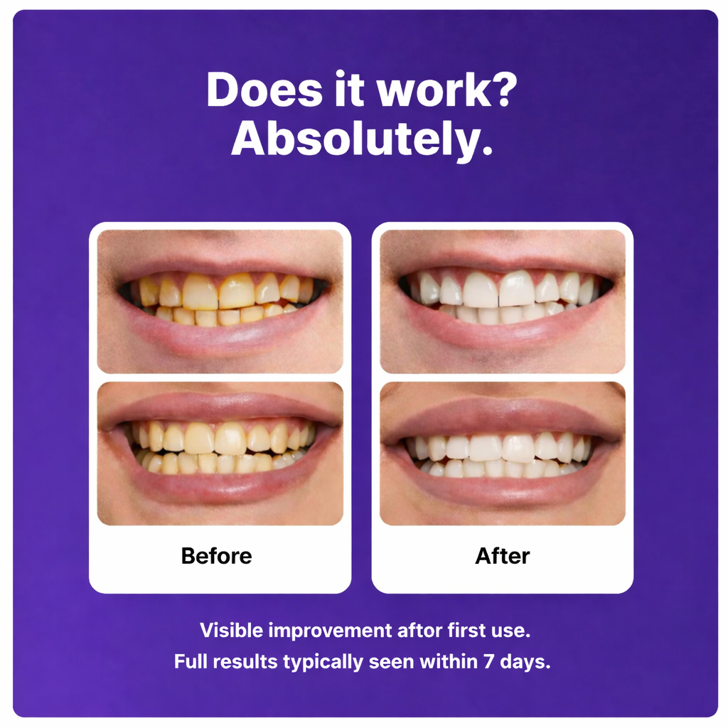 Transform Your Smile Within 30 Minutes Or Your Money Back!