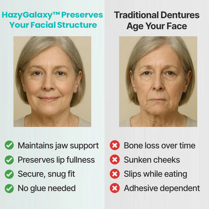 ✅🦷 HazyGalaxy™ Custom-Fit Dentures ⏰ ENDS TODAY 70% OFF | Smile with Confidence