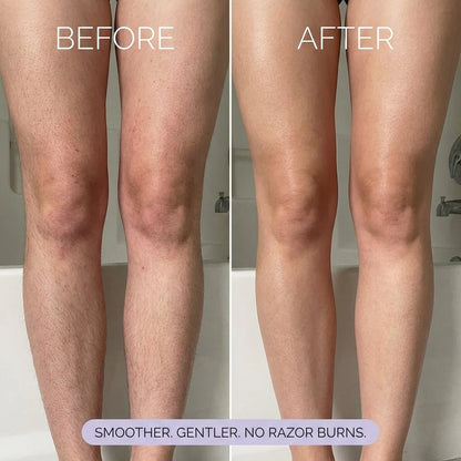 🔥Last Day 49% OFF -  Koas Hair Removal Mousse Hypoallergenic formula 🌿💧