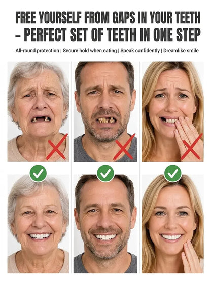 German Medical-Grade Snap-In Full Dentures